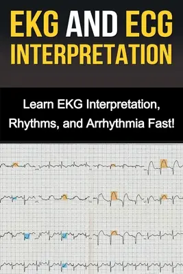 EKG und EKG-Interpretation: Lernen Sie EKG-Interpretation, Rhythmen und Arrhythmie schnell! - EKG and ECG Interpretation: Learn EKG Interpretation, Rhythms, and Arrhythmia Fast!