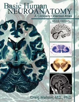 Basic Human Neuroanatomy: Un atlas orientat clinic - Basic Human Neuroanatomy: A Clinically Oriented Atlas