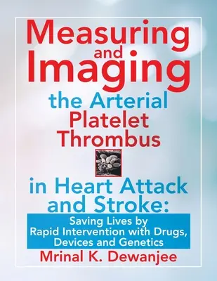 Measuring and Imaging the Arterial Platelet Thrombus in Heart Attack and Stroke: Salvarea de vieți prin intervenție rapidă cu medicamente, dispozitive și genetică - Measuring and Imaging the Arterial Platelet Thrombus in Heart Attack and Stroke: Saving Lives by Rapid Intervention with Drugs, Devices and Genetics