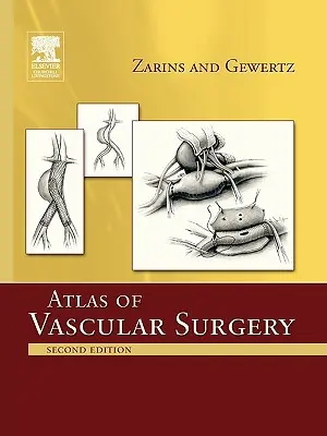 Atlas de chirurgie vasculară - ediție de carte - Atlas of Vascular Surgery - Paperback Edition