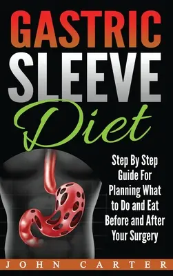 Dieta Gastric Sleeve: Ghid pas cu pas pentru planificarea a ceea ce trebuie să faceți și să mâncați înainte și după operație - Gastric Sleeve Diet: Step By Step Guide For Planning What to Do and Eat Before and After Your Surgery