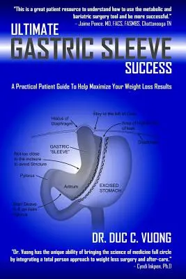 Succesul final al sleevei gastrice: Un ghid practic al pacientului pentru a vă ajuta să vă maximizați rezultatele pierderii în greutate - Ultimate Gastric Sleeve Success: A Practical Patient Guide To Help Maximize Your Weight Loss Results