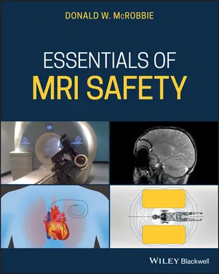 Principiile esențiale ale siguranței RMN - Essentials of MRI Safety