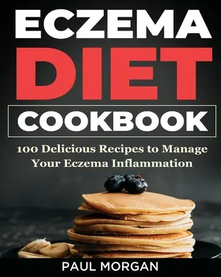 Eczema DIet Carte de bucate: 100 de rețete delicioase pentru a vă gestiona inflamația eczemelor - Eczema DIet Cookbook: 100 Delicious Recipes to Manage your Eczema Inflammation