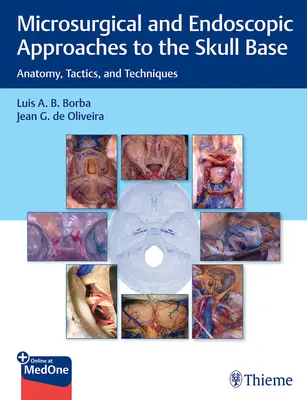 Abordări microchirurgicale și endoscopice la baza craniului: Anatomie, tactici și tehnici - Microsurgical and Endoscopic Approaches to the Skull Base: Anatomy, Tactics, and Techniques