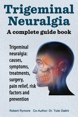 Nevralgia trigeminală: un ghid complet. Nevralgia trigeminală: cauze, simptome, tratamente, intervenții chirurgicale, - Trigeminal neuralgia: a complete guide book. Trigeminal neuralgia: causes, symptoms, treatments, surgery,