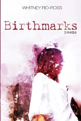 Semne de naștere - Birthmarks