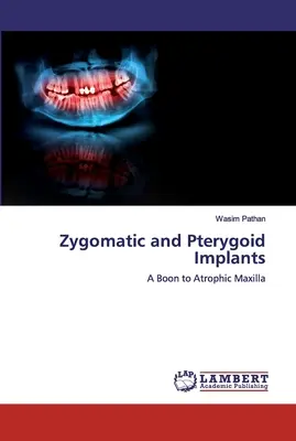 Implanturi zigomatice și pterigoide - Zygomatic and Pterygoid Implants