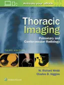 Imagistică toracică: Radiologie pulmonară și cardiovasculară - Thoracic Imaging: Pulmonary and Cardiovascular Radiology