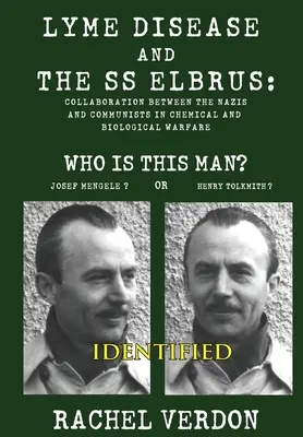 Boala Lyme și SS Elbrus - Lyme Disease and the SS Elbrus