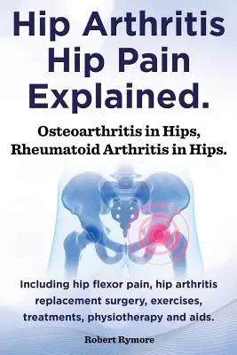 Artrita șoldului, durerea șoldului explicată. Osteoartrita în șolduri, artrita reumatoidă în șolduri. Inclusiv chirurgie pentru artrita șoldului, dureri ale flexorului șoldului, exerciții, - Hip Arthritis, Hip Pain Explained. Osteoarthritis in Hips, Rheumatoid Arthritis in Hips. Including Hip Arthritis Surgery, Hip Flexor Pain, Exercises,