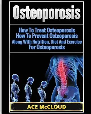 Osteoporoza: Cum Să Tratăm Osteoporoza: Cum Să Prevenim Osteoporoza: Împreună Cu Nutriție, Dieta Și Exercițiu Pentru Osteoporoză - Osteoporosis: How To Treat Osteoporosis: How To Prevent Osteoporosis: Along With Nutrition, Diet And Exercise For Osteoporosis