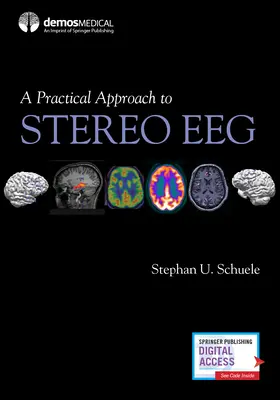 O abordare practică a Eeg stereo - A Practical Approach to Stereo Eeg