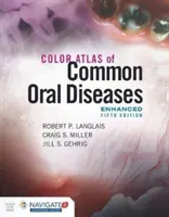 Atlas color al bolilor orale comune, ediție îmbunătățită - Color Atlas of Common Oral Diseases, Enhanced Edition