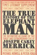 Adevărata istorie a Omului Elefant - True History of the Elephant Man