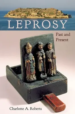 Lepra: trecut și prezent - Leprosy: Past and Present