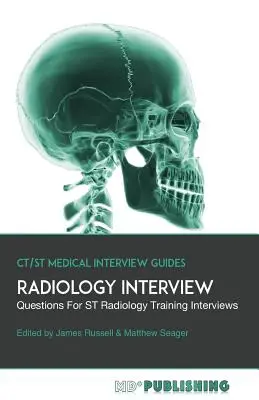 Interviu Radiologie: Ghidul definitiv cu peste 500 de întrebări de interviu pentru interviurile de formare în radiologie ST - Radiology Interview: The Definitive Guide With Over 500 Interview Questions For ST Radiology Training Interviews