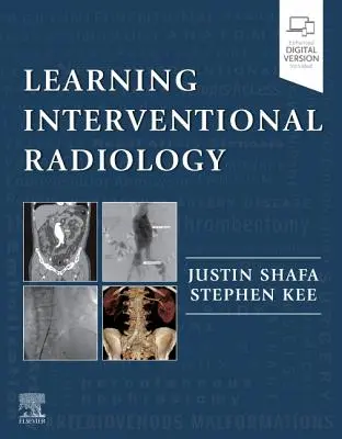 Învățarea radiologiei intervenționale - Learning Interventional Radiology