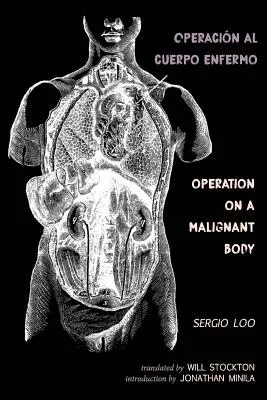 Operacin al Cuerpo Enfermo / Operație pe un corp malign - Operacin al Cuerpo Enfermo / Operation on a Malignant Body