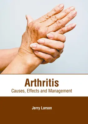 Artrita: Cauze, efecte și gestionare - Arthritis: Causes, Effects and Management