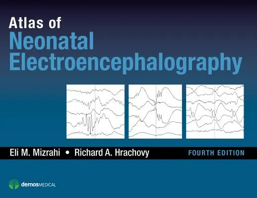 Atlas de electroencefalografie neonatală - Atlas of Neonatal Electroencephalography