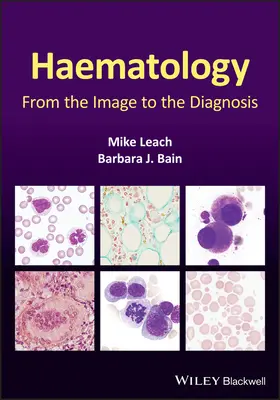 Hematologie: From the Image to the Diagnosis (De la imagine la diagnostic) - Haematology: From the Image to the Diagnosis