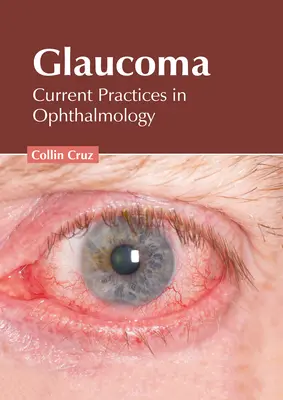 Glaucom: Practici actuale în oftalmologie - Glaucoma: Current Practices in Ophthalmology