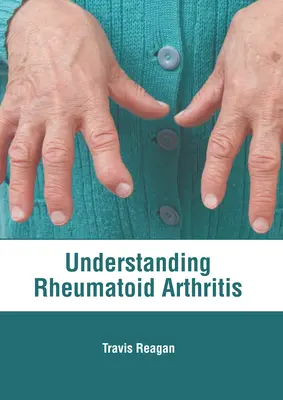 Înțelegerea artritei reumatoide - Understanding Rheumatoid Arthritis