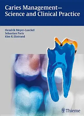 Managementul cariilor - știință și practică clinică - Caries Management - Science and Clinical Practice