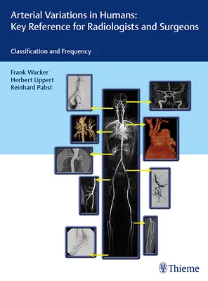 Variații arteriale la om: Key Reference for Radiologists and Surgeons: Clasificări și frecvență - Arterial Variations in Humans: Key Reference for Radiologists and Surgeons: Classifications and Frequency