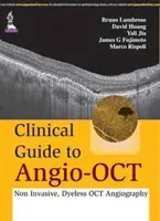Ghid clinic pentru Angio-OCT: Angiografie OCT neinvazivă, fără dye - Clinical Guide to Angio-OCT: Non Invasive, Dyeless OCT Angiography