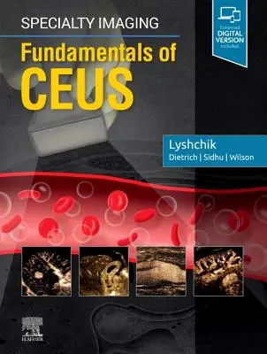 Specialty Imaging: Fundamente de Ceus - Specialty Imaging: Fundamentals of Ceus