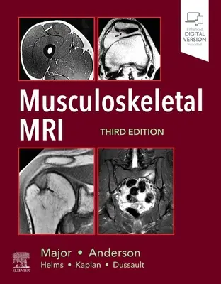 RMN musculo-scheletal - Musculoskeletal MRI