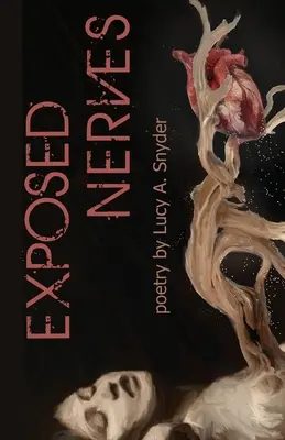 Nervi expuși - Exposed Nerves