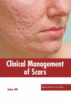 Managementul clinic al cicatricilor - Clinical Management of Scars