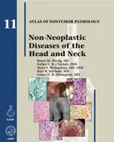 Boli neoplazice ale capului și gâtului (Non-Neoplastic Diseases of the Head and Neck) - Non-Neoplastic Diseases of the Head and Neck