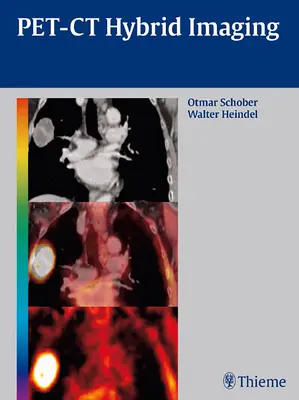 Imagistica hibridă Pet-CT - Pet-CT Hybrid Imaging