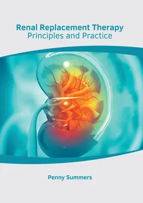 Terapia de substituție renală: Principii și practică - Renal Replacement Therapy: Principles and Practice