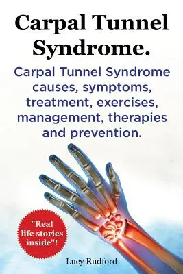 Sindromul tunelului carpian, Cts. Sindromul Tunelului Carpian, Cts Cauze, Simptome, Tratament, Exerciții, Management, Terapii și Prevenire. - Carpal Tunnel Syndrome, Cts. Carpal Tunnel Syndrome Cts Causes, Symptoms, Treatment, Exercises, Management, Therapies and Prevention.