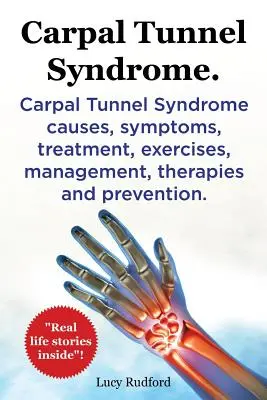 Sindromul tunelului carpian. Sindromul tunelului carpian cauze, simptome, tratament, exerciții, gestionare, terapii și prevenire. Povești de viață reale în interior! - Carpal Tunnel Syndrome. Carpal Tunnel Syndrome causes, symptoms, treatment, exercises, management, therapies and prevention. Real Life Stories Inside!