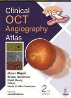 Atlas clinic de angiografie OCT - Clinical OCT Angiography Atlas