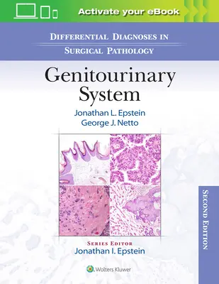Diagnostice diferențiale în patologia chirurgicală: Sistemul genito-urinar - Differential Diagnoses in Surgical Pathology: Genitourinary System