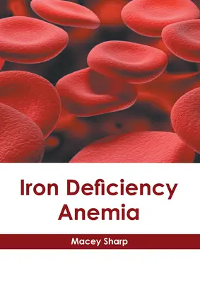 Anemia cu deficit de fier - Iron Deficiency Anemia