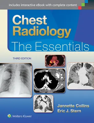 Radiologie toracică: Esențial - Chest Radiology: The Essentials