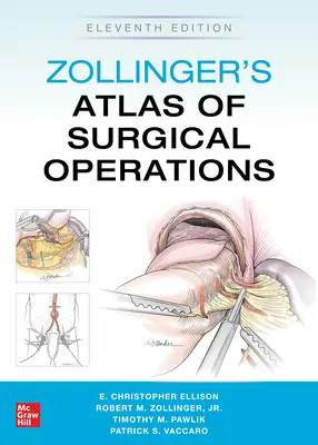 Zollinger's Atlas of Surgical Operations, ediția a unsprezecea - Zollinger's Atlas of Surgical Operations, Eleventh Edition
