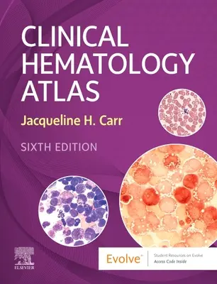 Atlas de hematologie clinică (Carr Jacqueline H. (Laboratory Manager Department of Pathology and Laboratory Medicine Clarian Health Indianapolis IN)) - Clinical Hematology Atlas (Carr Jacqueline H. (Laboratory Manager Department of Pathology and Laboratory Medicine Clarian Health Indianapolis IN))