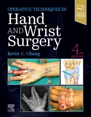 Tehnici operatorii: Chirurgia mâinii și a încheieturii mâinii - Operative Techniques: Hand and Wrist Surgery