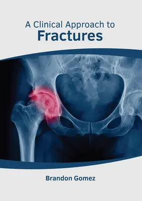 O abordare clinică a fracturilor - A Clinical Approach to Fractures