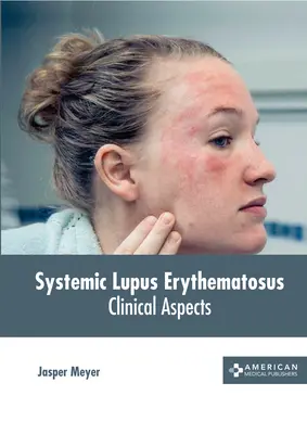 Lupus eritematos sistemic (Systemic Lupus Erythematosus): Aspecte clinice - Systemic Lupus Erythematosus: Clinical Aspects