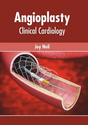 Angioplastie: Cardiologie clinică - Angioplasty: Clinical Cardiology